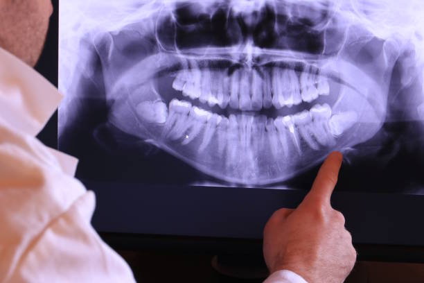 Best Emergency Denture Repair in Martinez, CA
